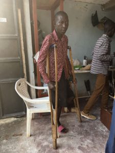 Mehr über den Artikel erfahren Prothesenversorgung in Uganda